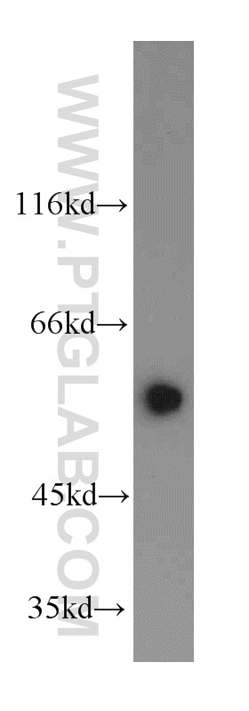 Western Blot (WB) analysis of HepG2 cells using SERPING1/C1 Inactivator Polyclonal antibody (12259-1-AP)