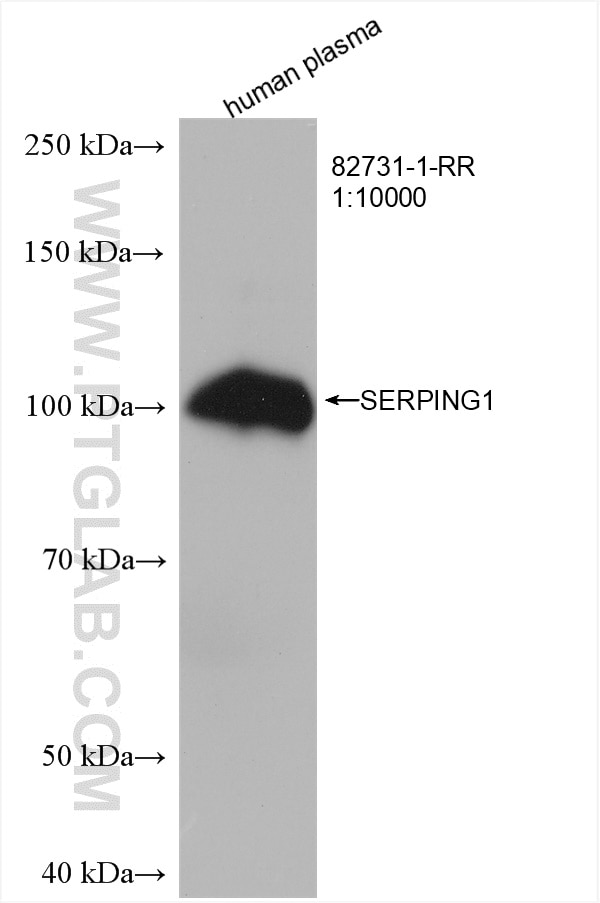Western Blot (WB) analysis of human plasma using SERPING1 Recombinant antibody (82731-1-RR)