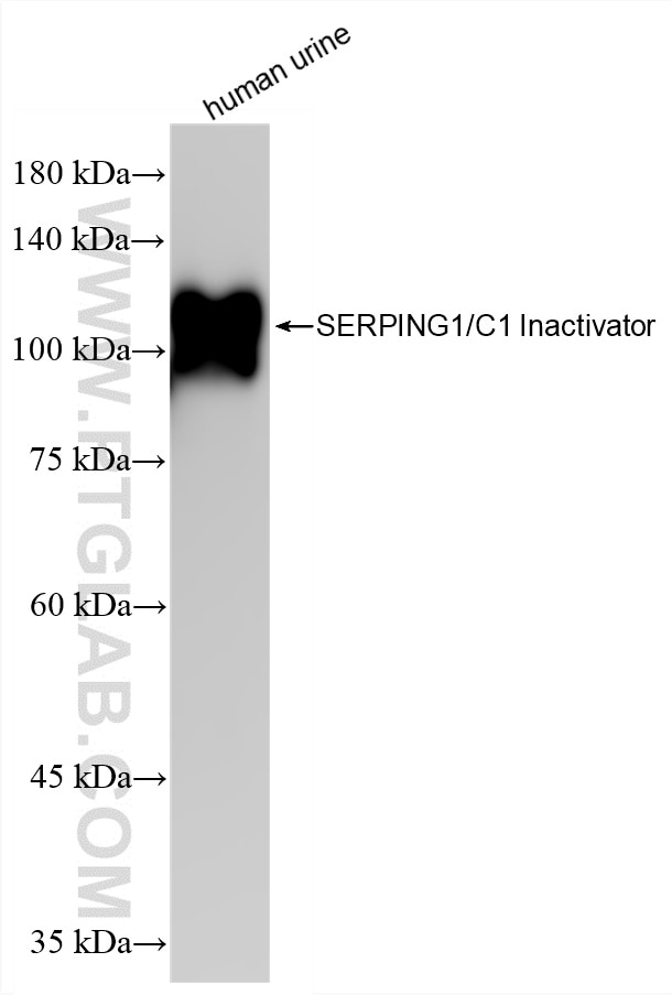 Western Blot (WB) analysis of human urine sample using SERPING1/C1 Inactivator Recombinant monoclonal ant (82731-1-RR)