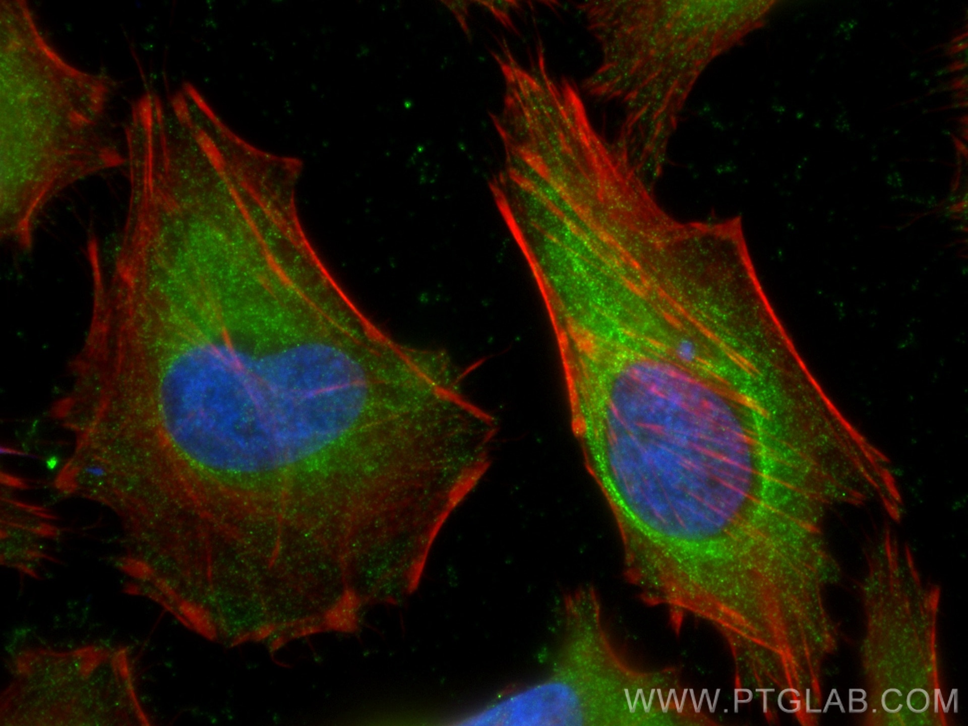 Immunofluorescence (IF) / fluorescent staining of HeLa cells using SERPING1/C1 Inactivator Monoclonal antibody (66882-1-Ig)