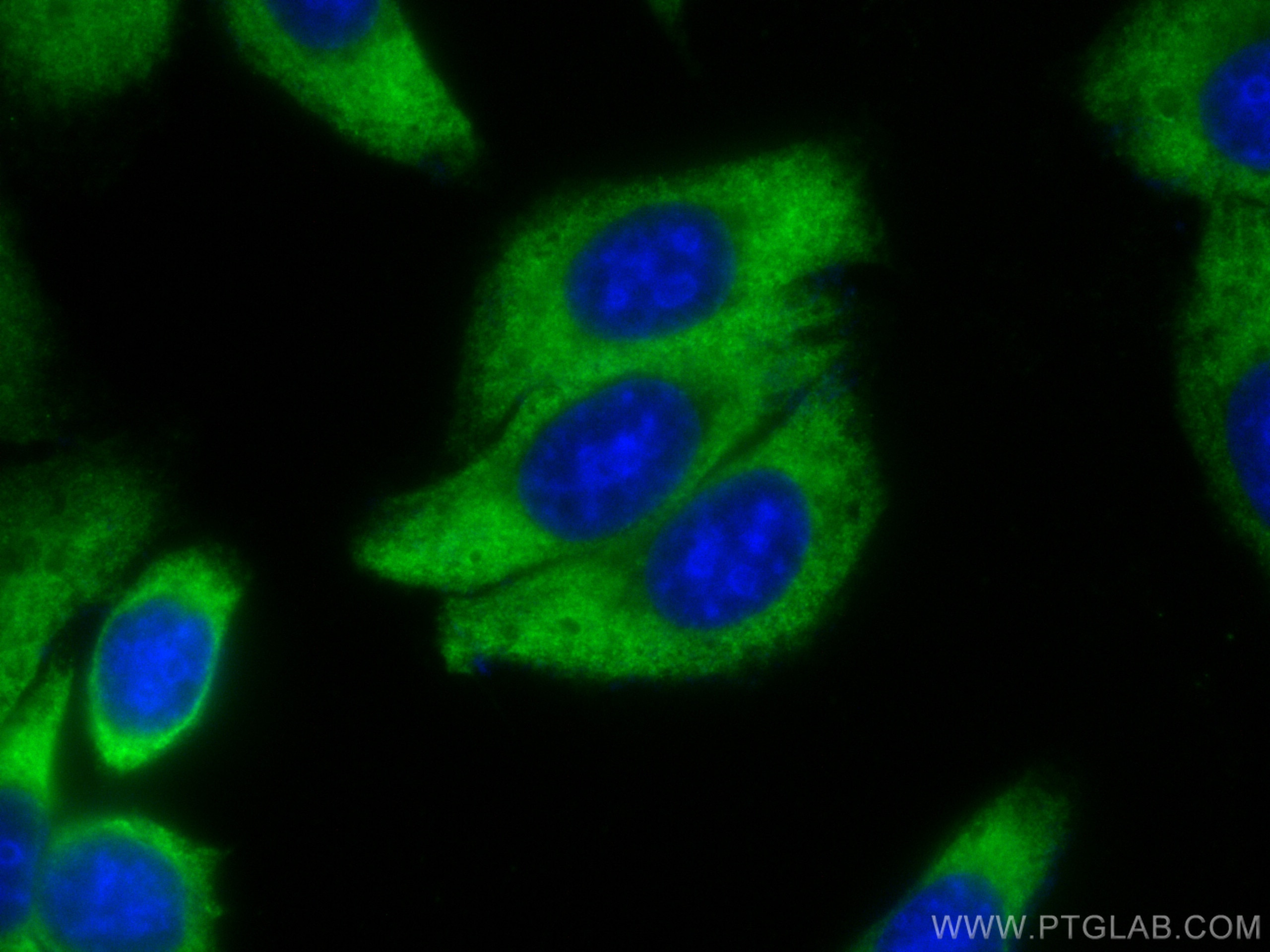 Immunofluorescence (IF) / fluorescent staining of HepG2 cells using CoraLite® Plus 488-conjugated SERPING1/C1 Inactiva (CL488-12259)