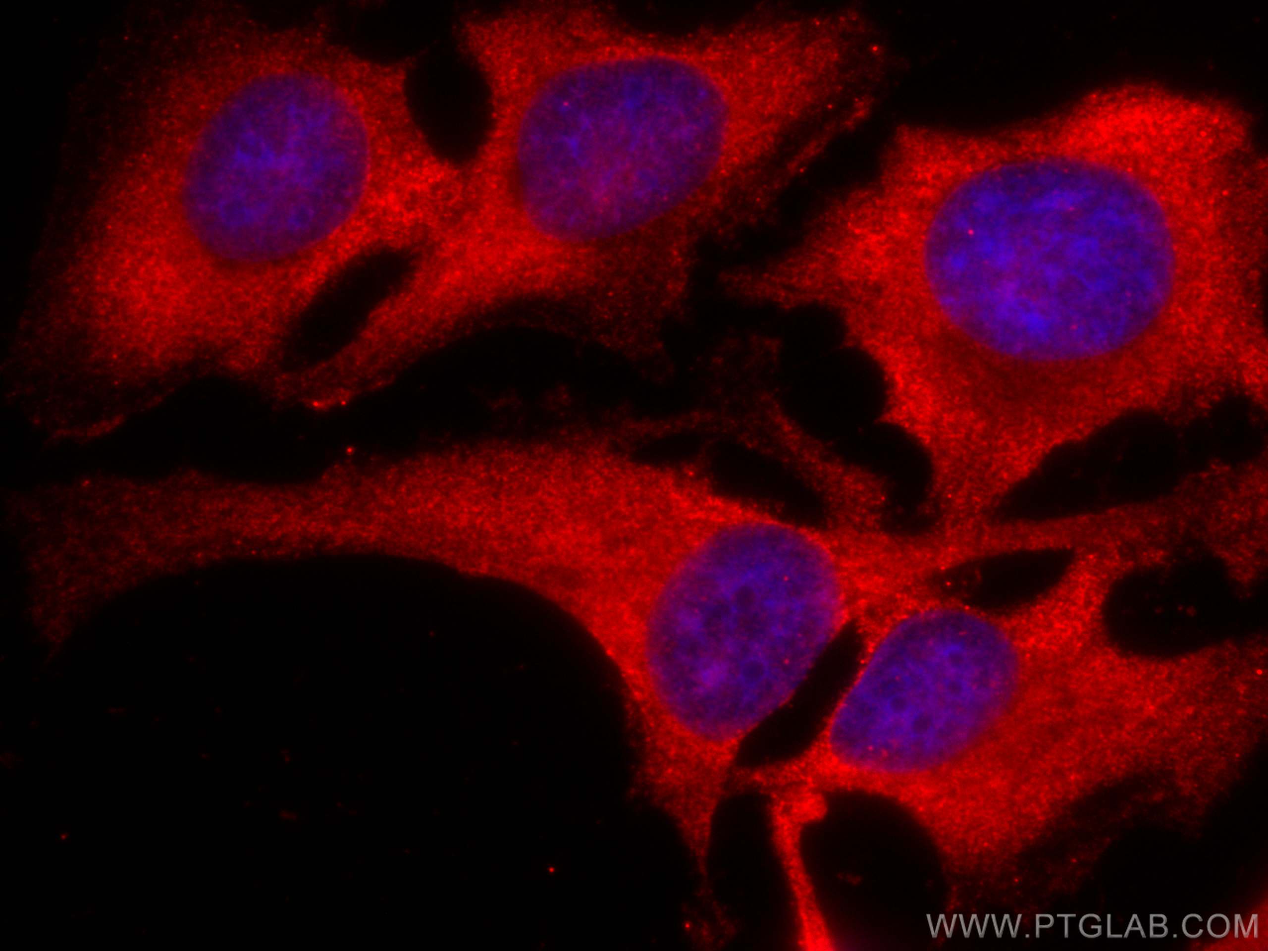 Immunofluorescence (IF) / fluorescent staining of HeLa cells using CoraLite®594-conjugated SERPING1/C1 Inactivator Mo (CL594-66882)