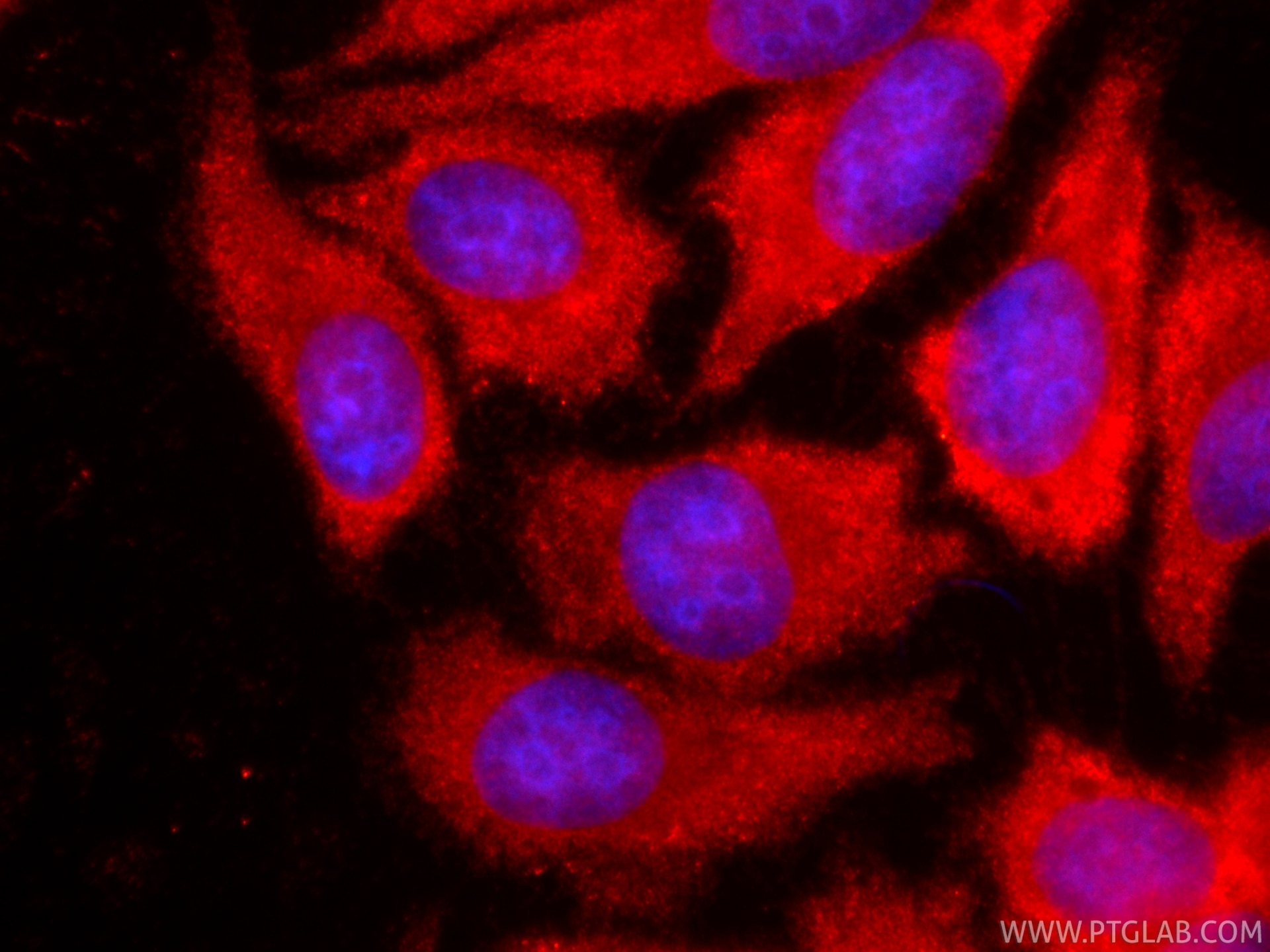 Immunofluorescence (IF) / fluorescent staining of HepG2 cells using CoraLite®594-conjugated SERPING1/C1 Inactivator Mo (CL594-66882)