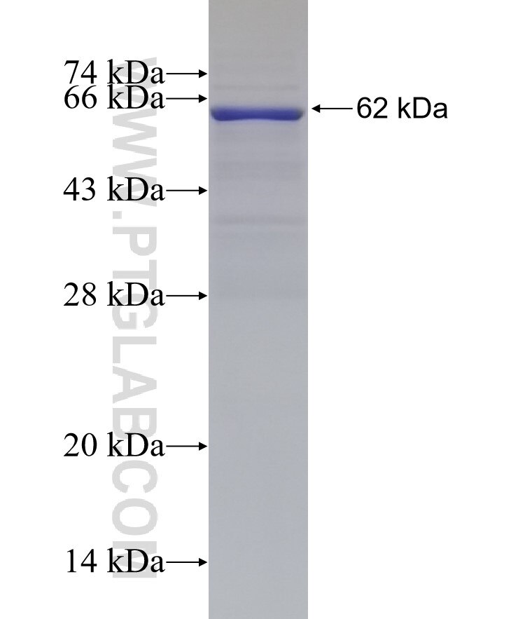 SERPING1 fusion protein Ag2819 SDS-PAGE