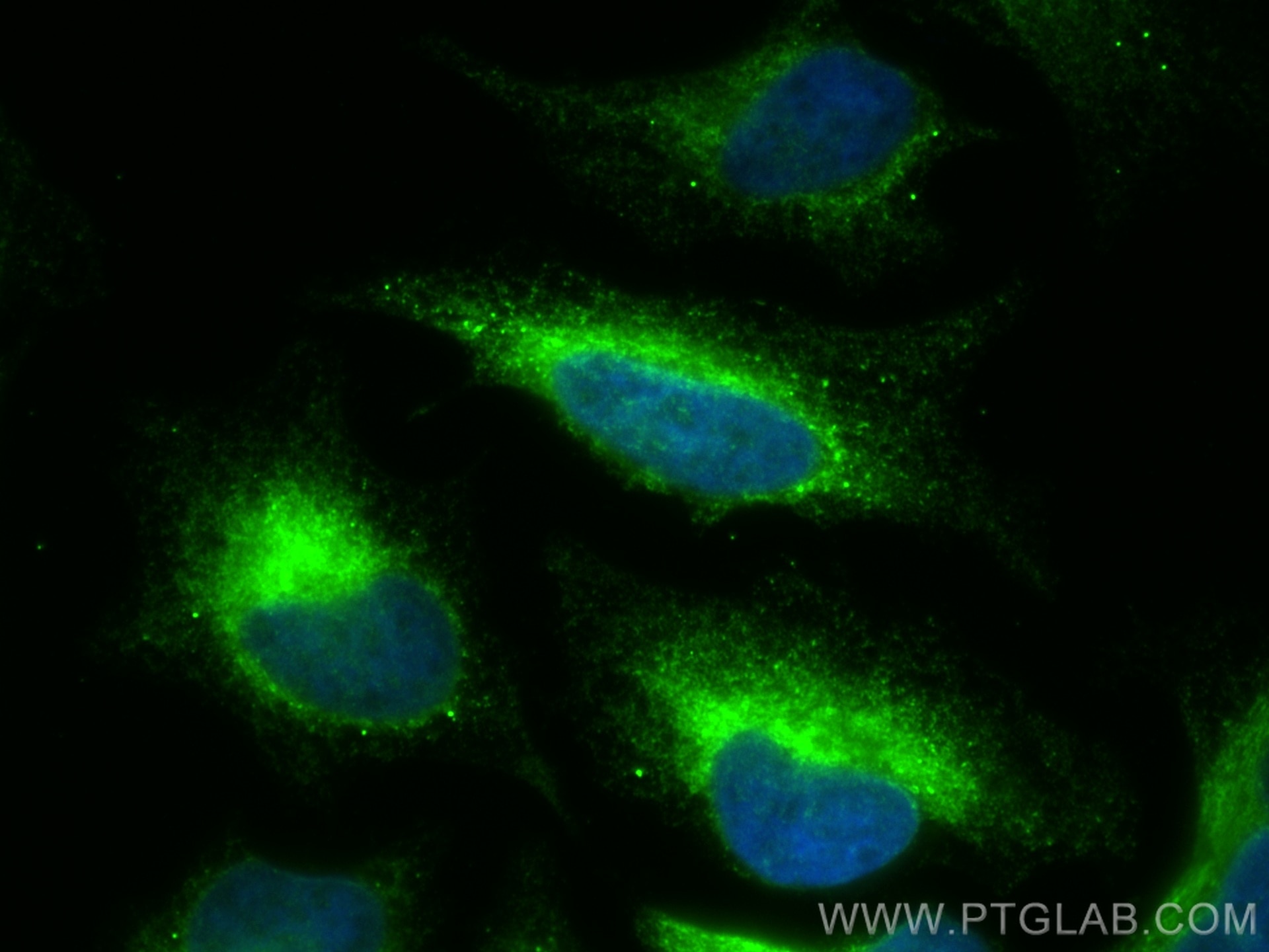 Immunofluorescence (IF) / fluorescent staining of HeLa cells using HSP47 Polyclonal antibody (10875-1-AP)
