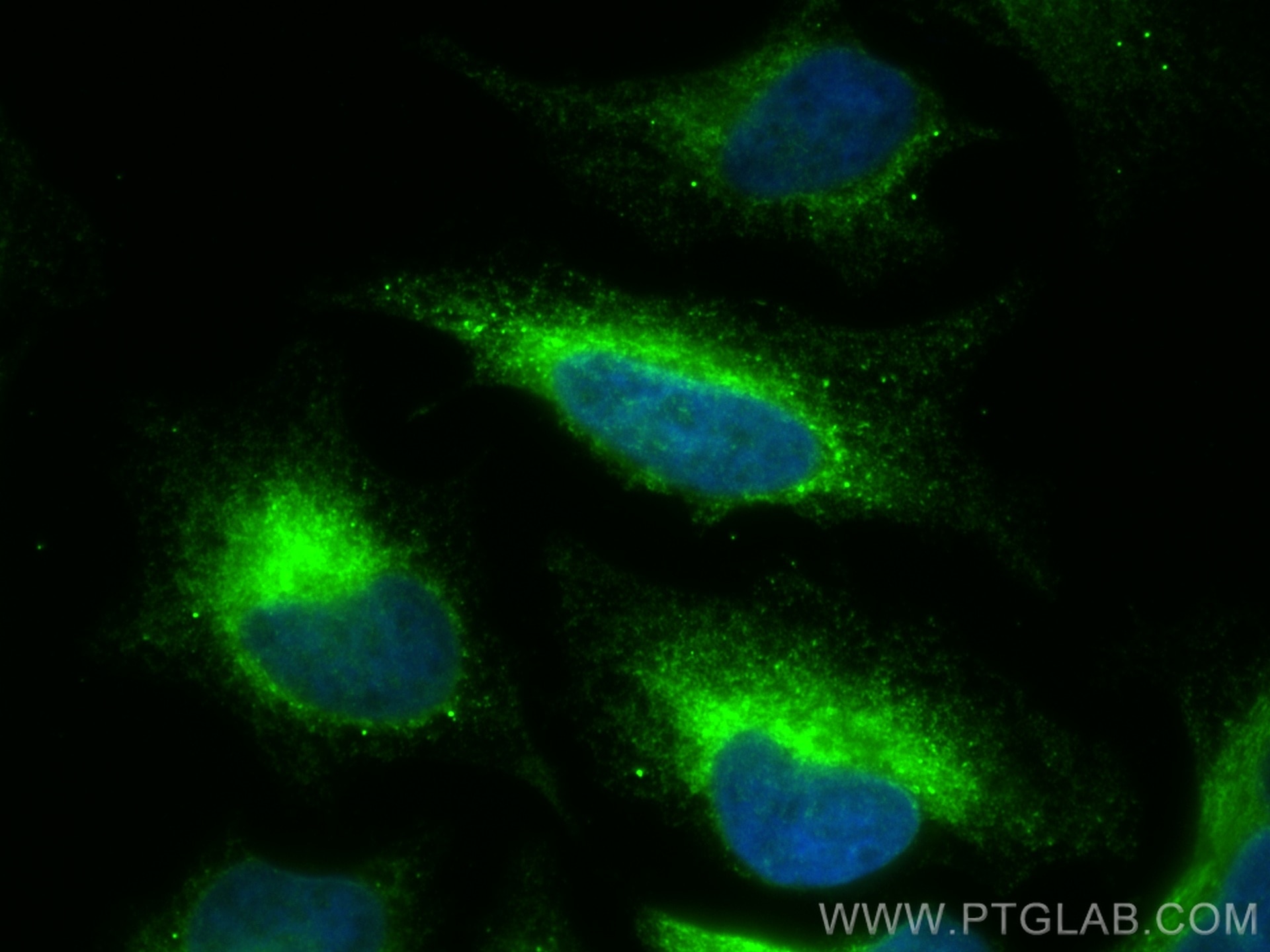 IF Staining of HeLa using 10875-1-AP