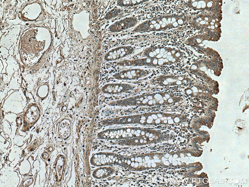 Immunohistochemistry (IHC) staining of human colon tissue using HSP47 Polyclonal antibody (10875-1-AP)
