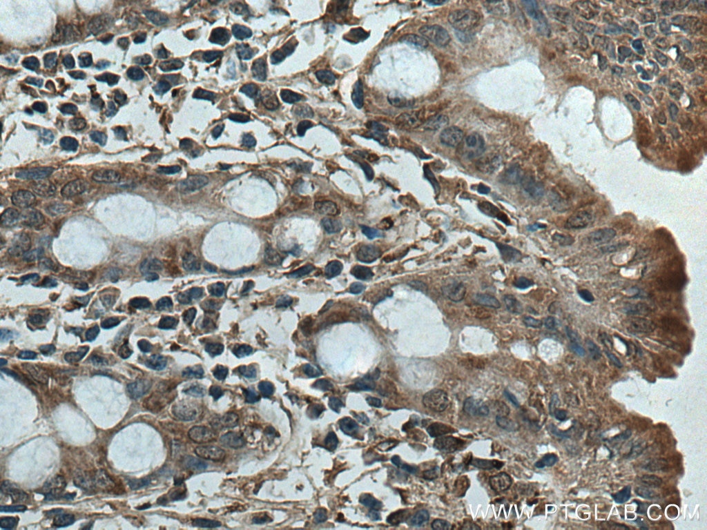 Immunohistochemistry (IHC) staining of human colon tissue using HSP47 Polyclonal antibody (10875-1-AP)