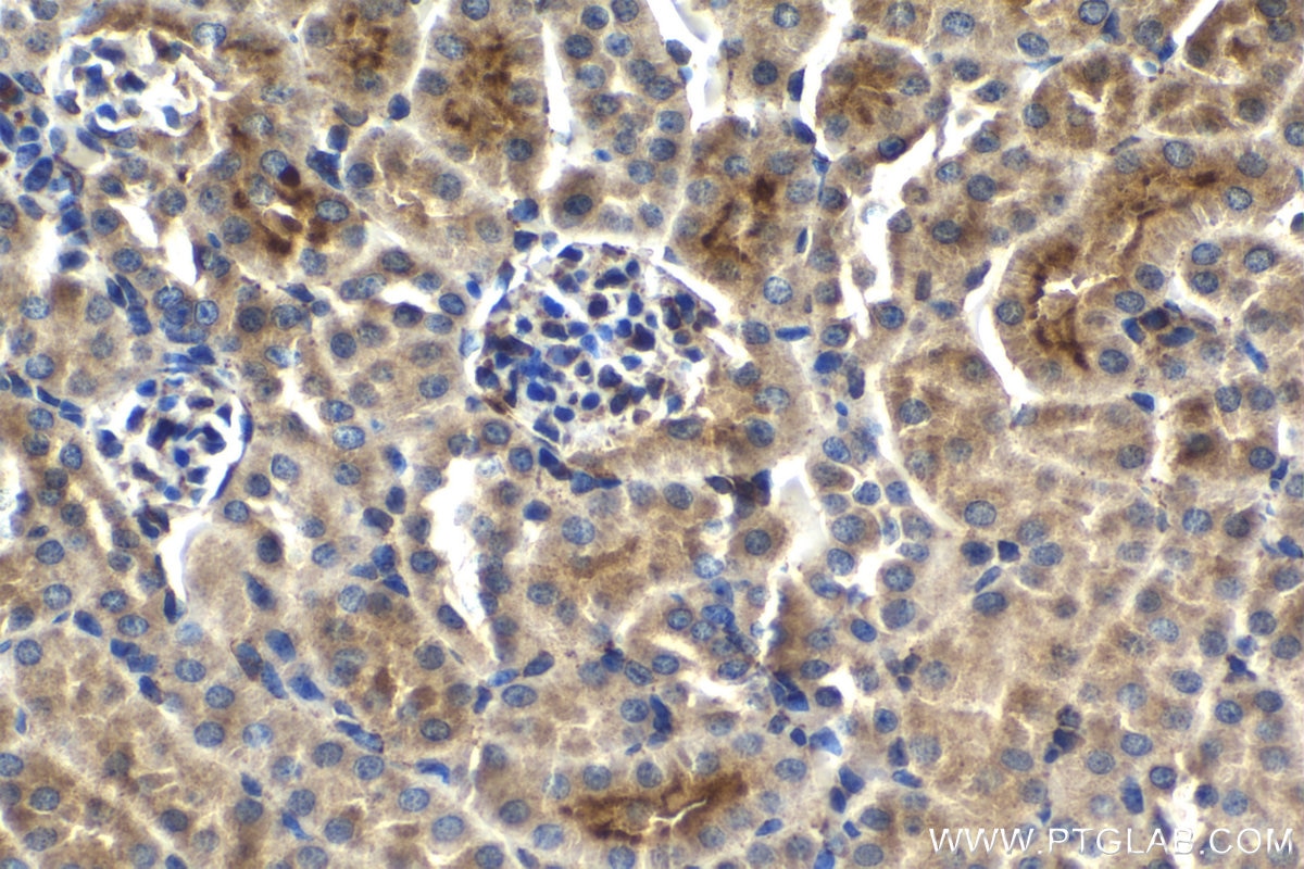 Immunohistochemistry (IHC) staining of mouse kidney tissue using HSP47 Polyclonal antibody (10875-1-AP)