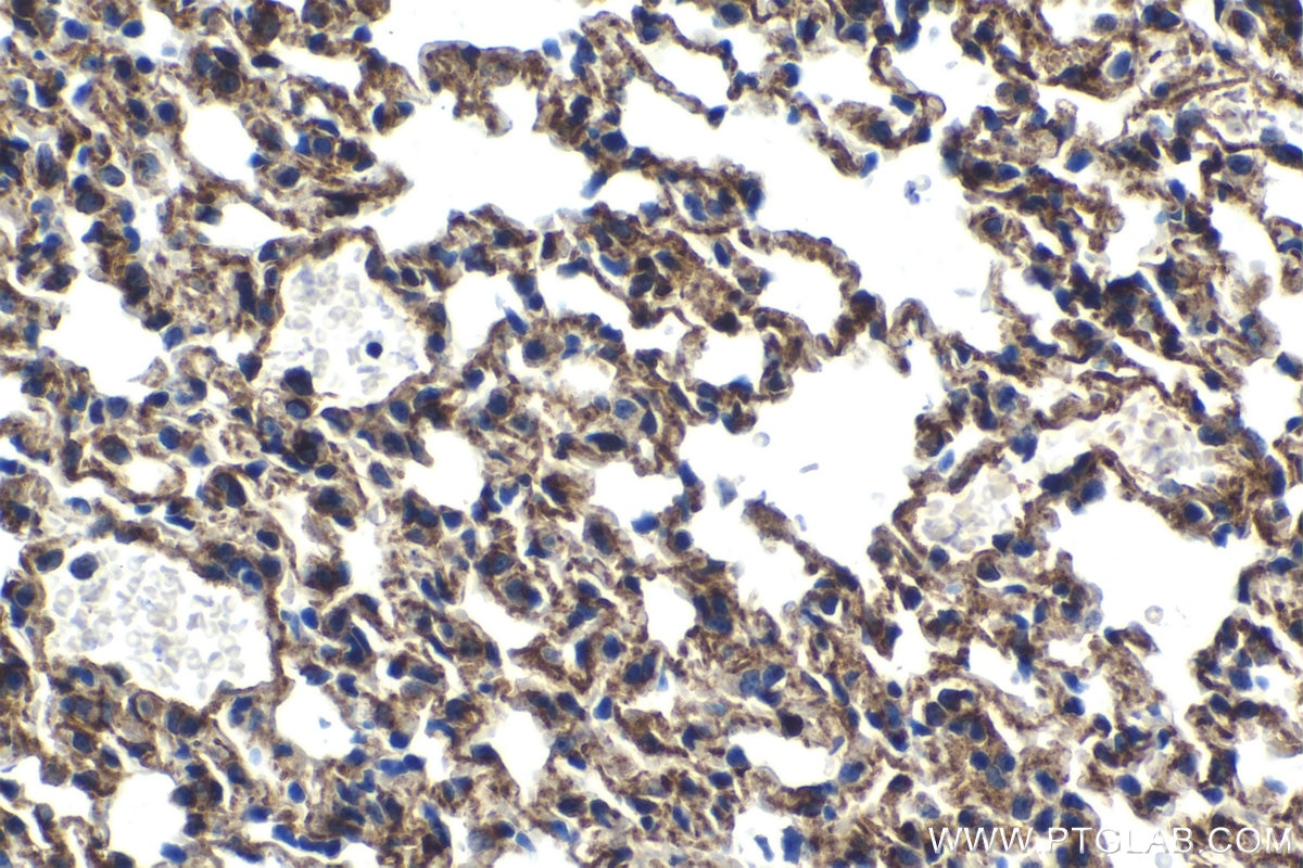 Immunohistochemistry (IHC) staining of mouse lung tissue using HSP47 Polyclonal antibody (10875-1-AP)