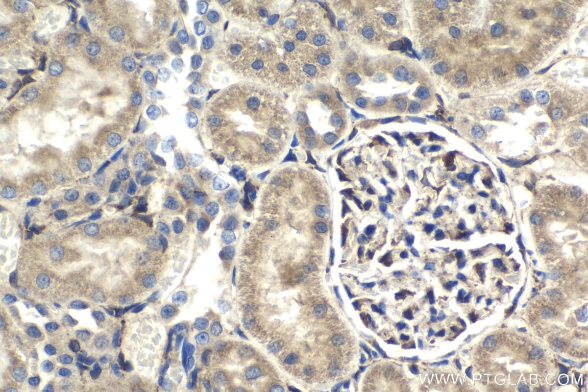 Immunohistochemistry (IHC) staining of rat kidney tissue using HSP47 Polyclonal antibody (10875-1-AP)