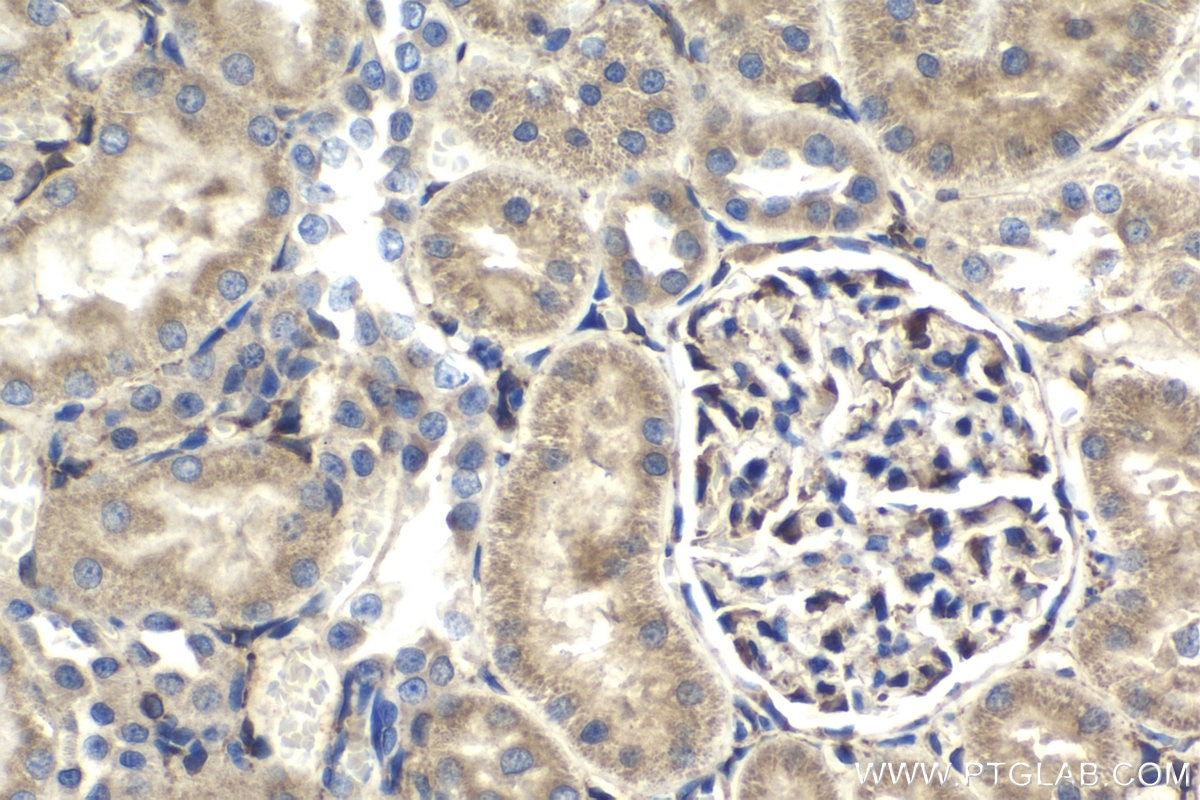 IHC staining of rat kidney using 10875-1-AP