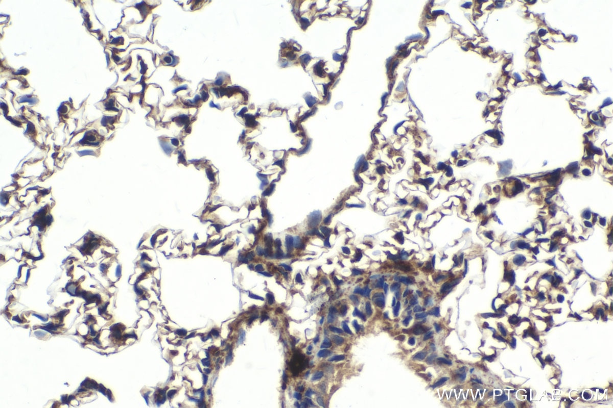 Immunohistochemistry (IHC) staining of rat lung tissue using HSP47 Polyclonal antibody (10875-1-AP)