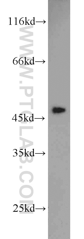 HSP47 Polyclonal antibody