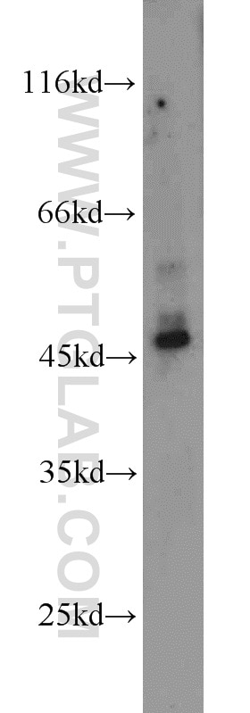 Western Blot (WB) analysis of A431 cells using HSP47 Polyclonal antibody (10875-1-AP)