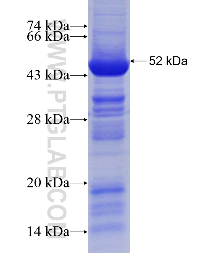 SERPINH1 fusion protein Ag30999 SDS-PAGE