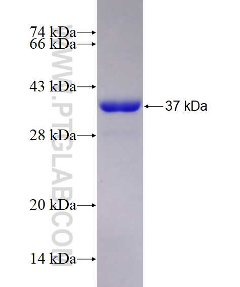 SERPINI1 fusion protein Ag28636 SDS-PAGE