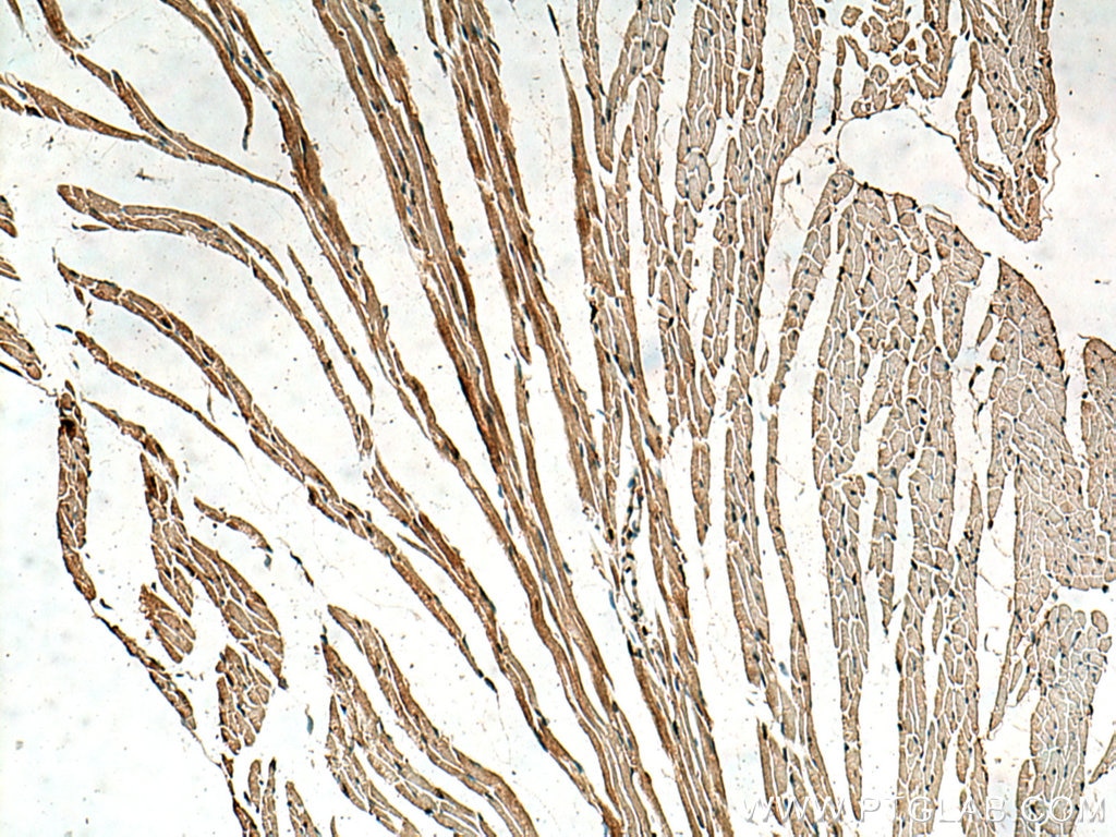 Immunohistochemistry (IHC) staining of mouse heart tissue using SERTAD1 Polyclonal antibody (10167-1-AP)