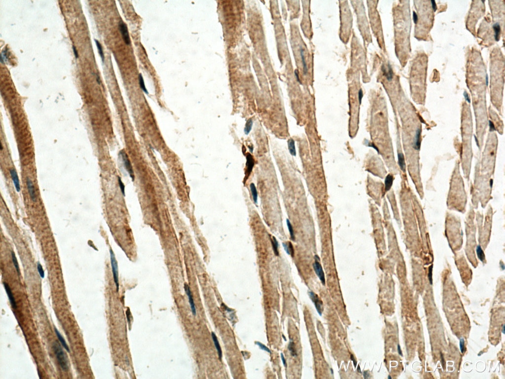 Immunohistochemistry (IHC) staining of mouse heart tissue using SERTAD1 Polyclonal antibody (10167-1-AP)