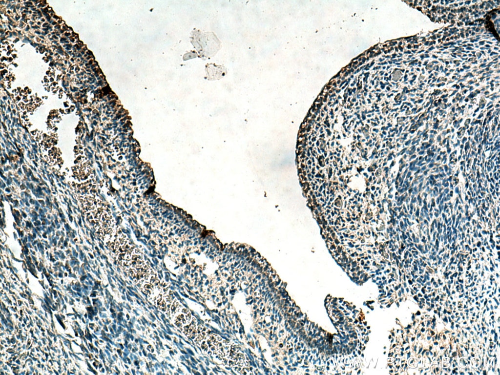 IHC staining of mouse embryo using 10167-1-AP