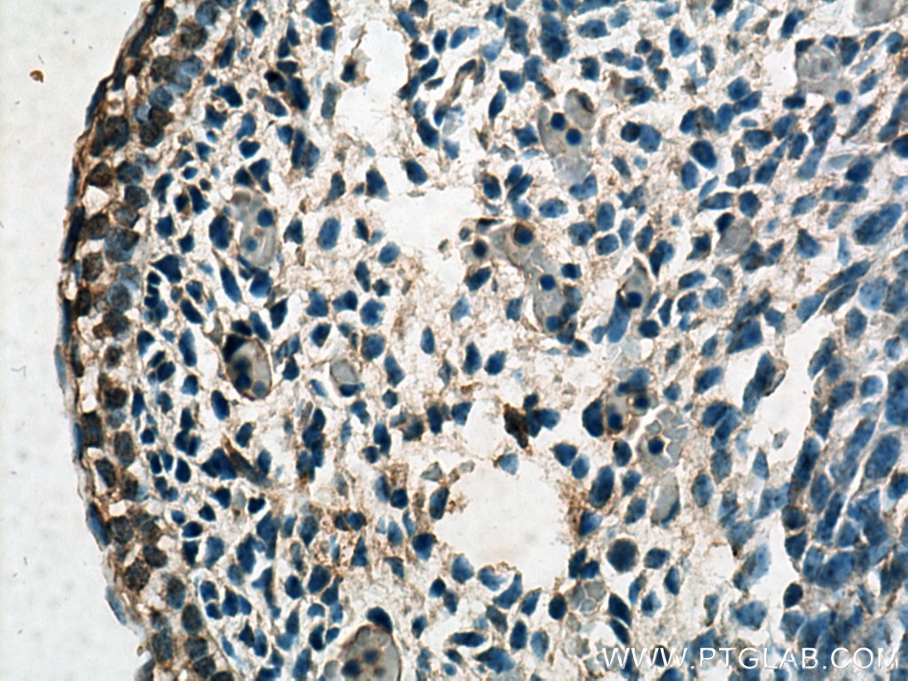 Immunohistochemistry (IHC) staining of mouse embryo tissue using SERTAD1 Polyclonal antibody (10167-1-AP)