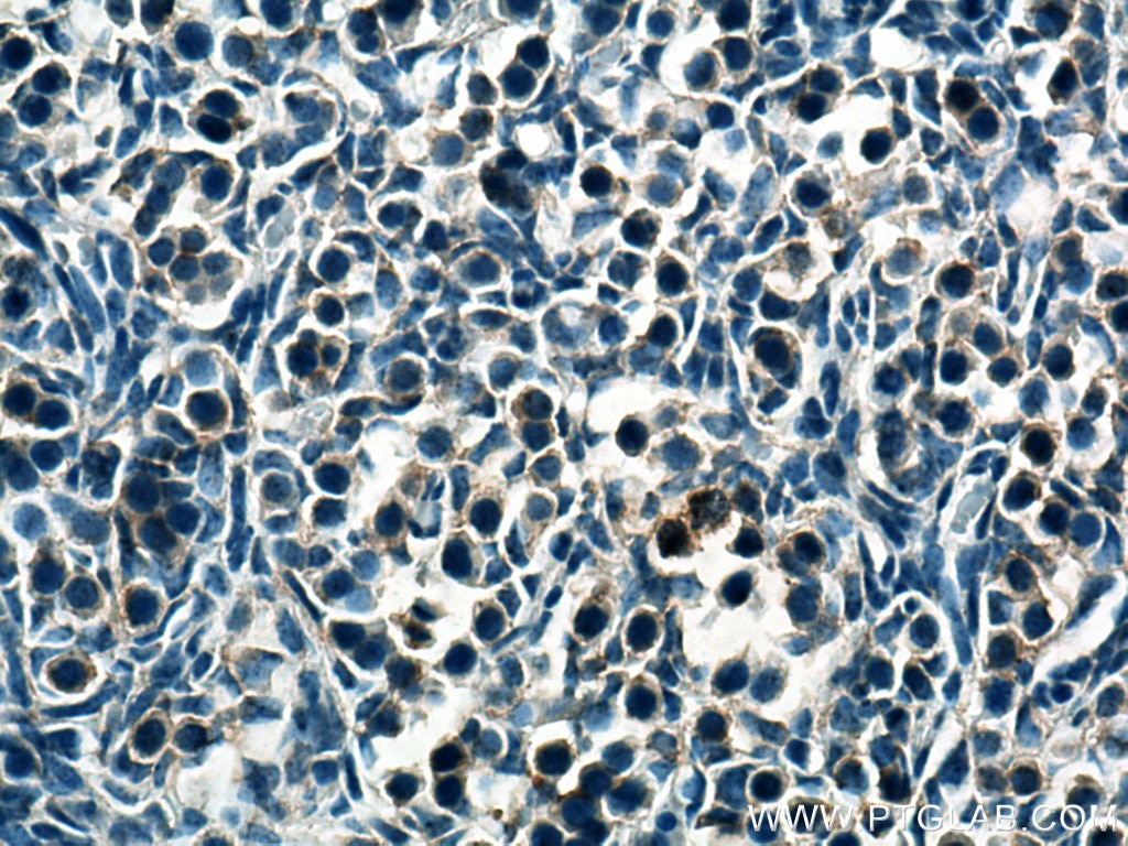 Immunohistochemistry (IHC) staining of mouse embryo tissue using SERTAD1 Polyclonal antibody (10167-1-AP)