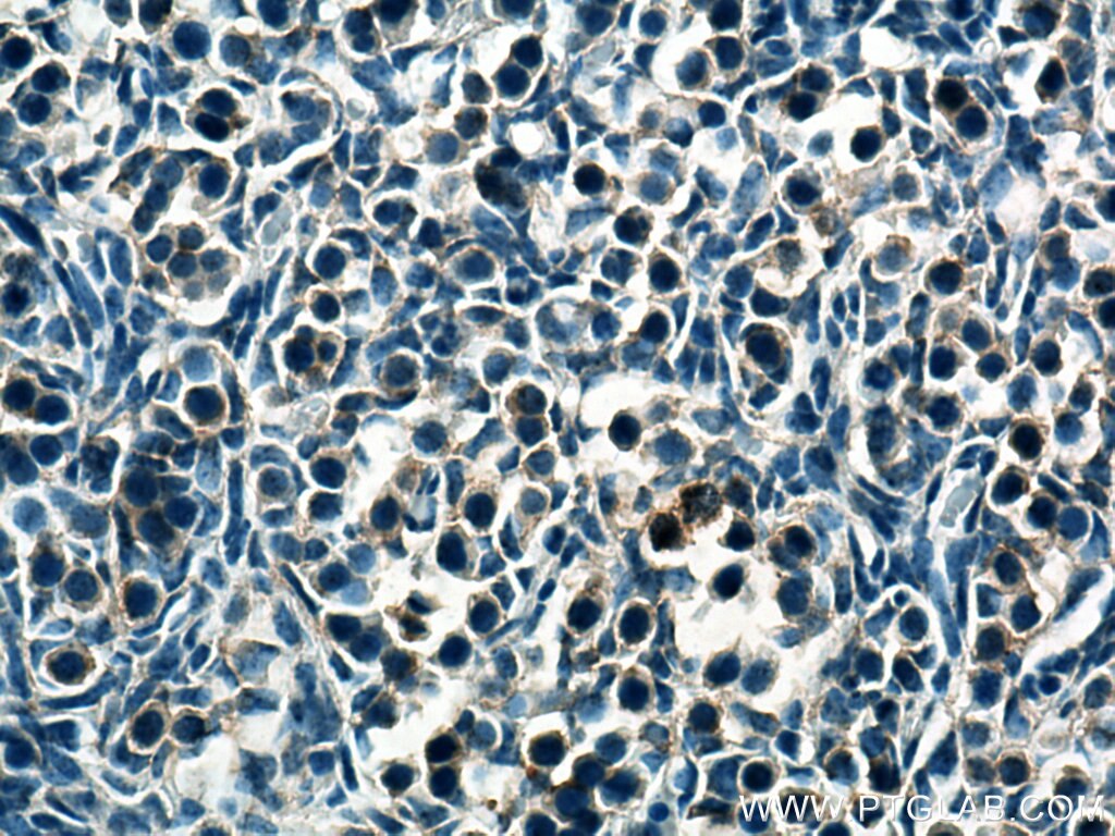 Immunohistochemistry (IHC) staining of mouse embryo tissue using SERTAD1 Polyclonal antibody (10167-1-AP)