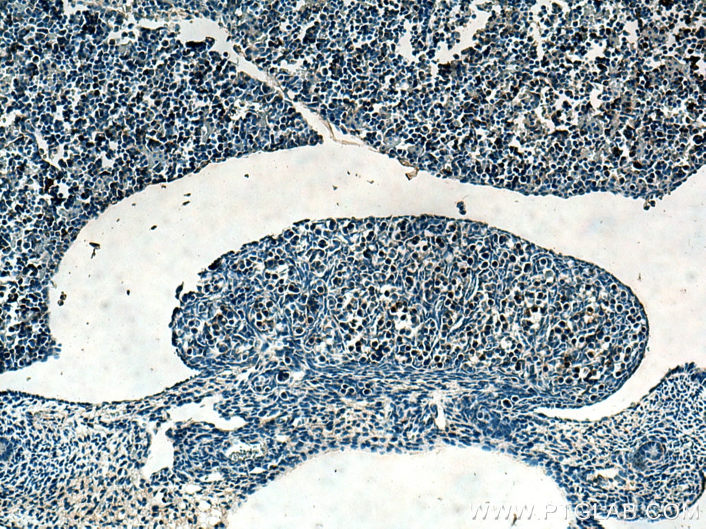 Immunohistochemistry (IHC) staining of mouse embryo tissue using SERTAD1 Polyclonal antibody (10167-1-AP)