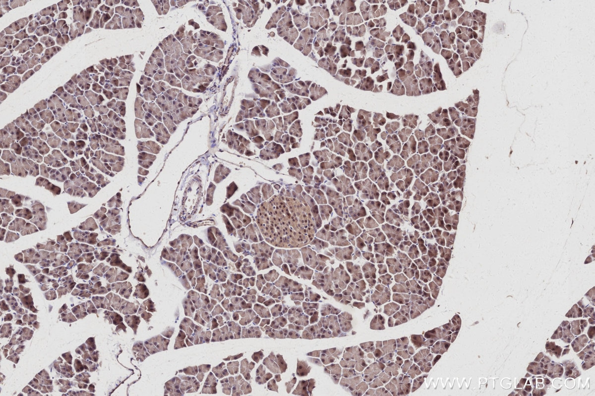 IHC staining of mouse pancreas using 10167-1-AP Immunohistochemistry (IHC) staining of mouse pancreas tissue using SERTAD1 Polyclonal antibody (10167-1-AP)