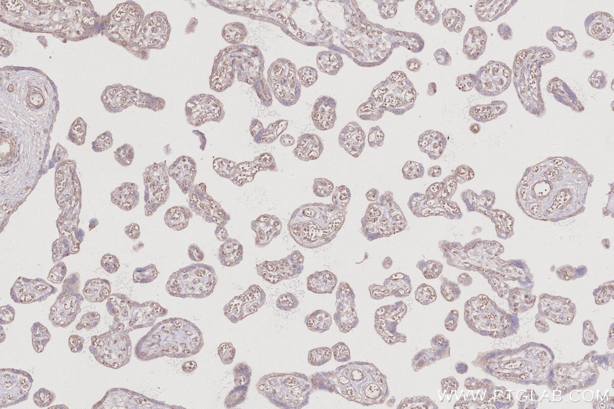 IHC staining of human placenta using 10167-1-AP Immunohistochemistry (IHC) staining of human placenta tissue using SERTAD1 Polyclonal antibody (10167-1-AP)