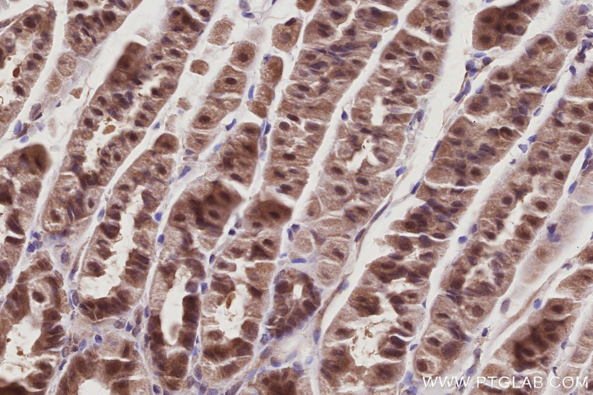 IHC staining of mouse stomach using 10167-1-AP Immunohistochemistry (IHC) staining of mouse stomach tissue using SERTAD1 Polyclonal antibody (10167-1-AP)