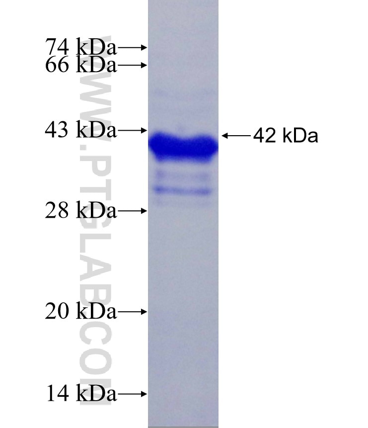 SERTAD1 fusion protein Ag29267 SDS-PAGE
