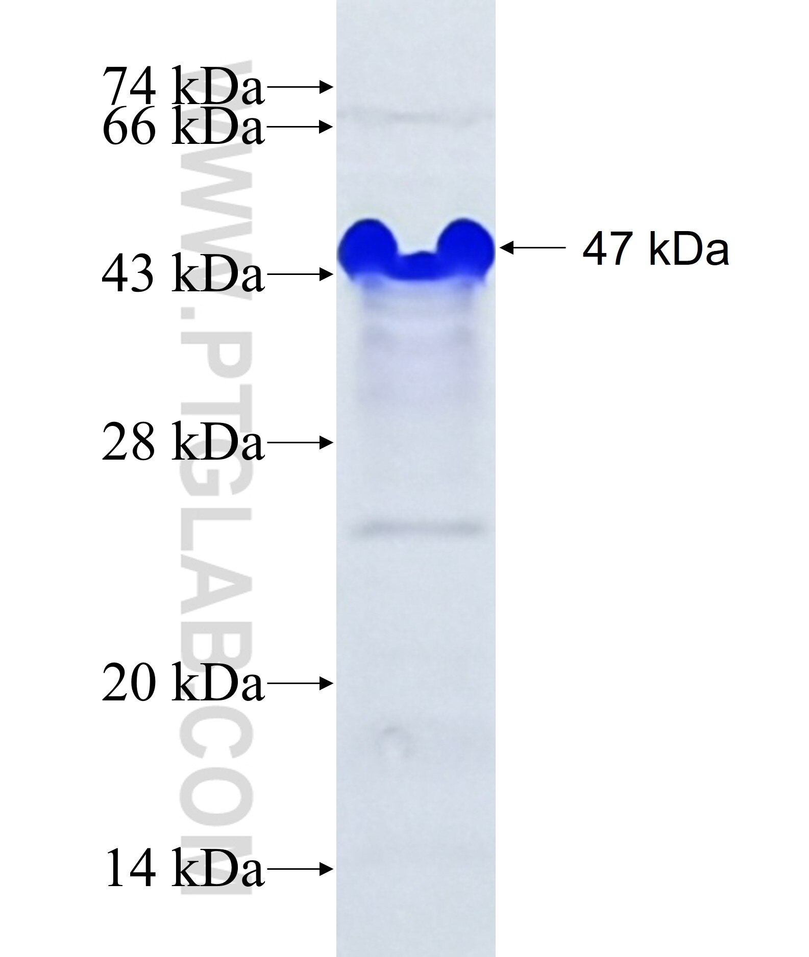 SERTAD2 fusion protein Ag37578 SDS-PAGE SERTAD2 fusion protein Ag37578 SDS-PAGE