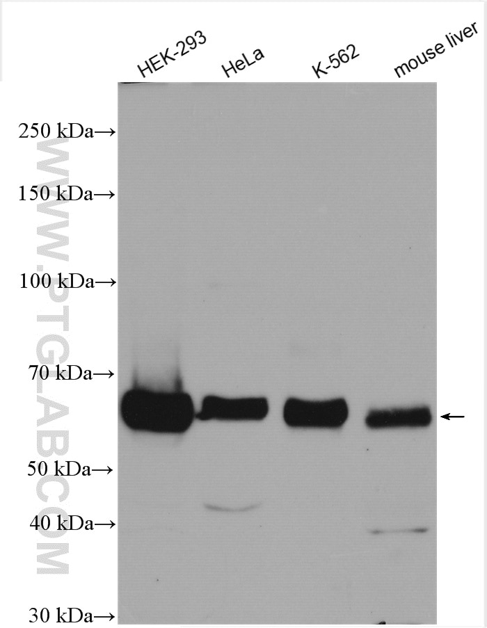 Western Blot (WB) analysis of various lysates using SESN1 Polyclonal antibody (21668-1-AP)