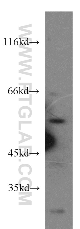 Western Blot (WB) analysis of mouse liver tissue using SESN1 Polyclonal antibody (21668-1-AP)