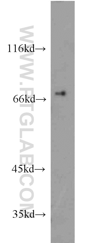 Western Blot (WB) analysis of human testis tissue using SESN1 Polyclonal antibody (21668-1-AP)