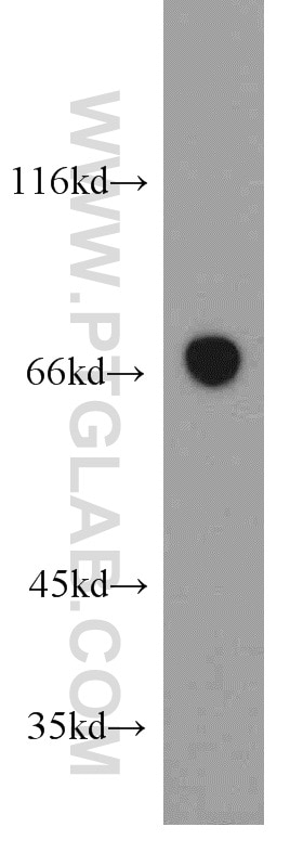 Western Blot (WB) analysis of human skeletal muscle tissue using SESN1 Polyclonal antibody (21668-1-AP)