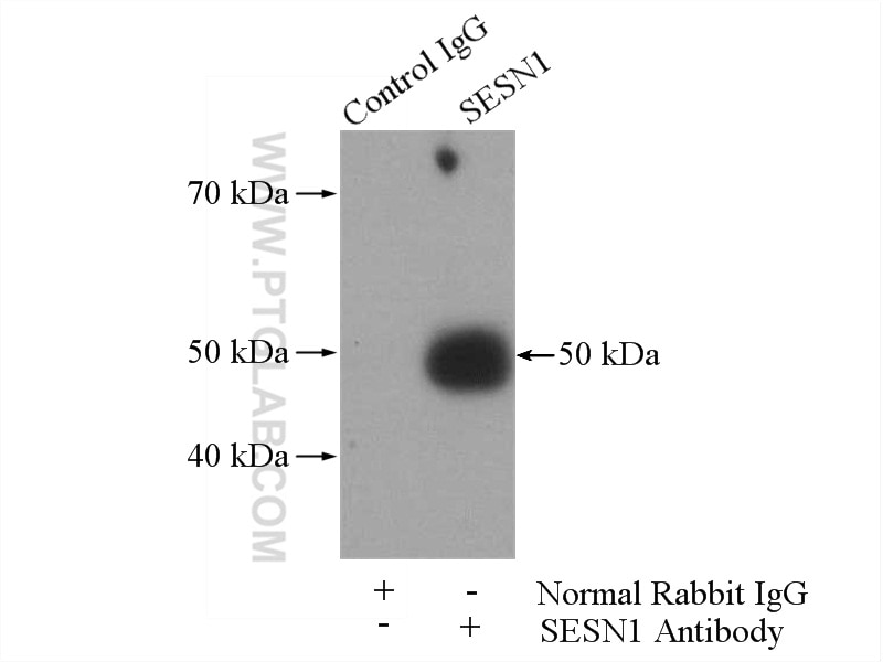 Immunoprecipitation (IP) experiment of mouse brain tissue using SESN1 Polyclonal antibody (55010-1-AP)