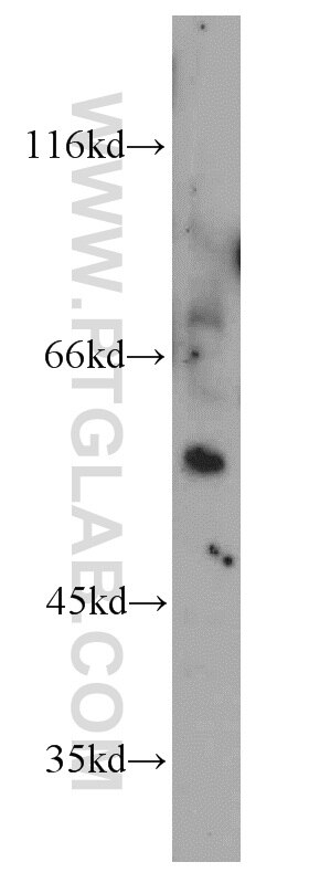 Western Blot (WB) analysis of mouse brain tissue using SESN1 Polyclonal antibody (55010-1-AP)