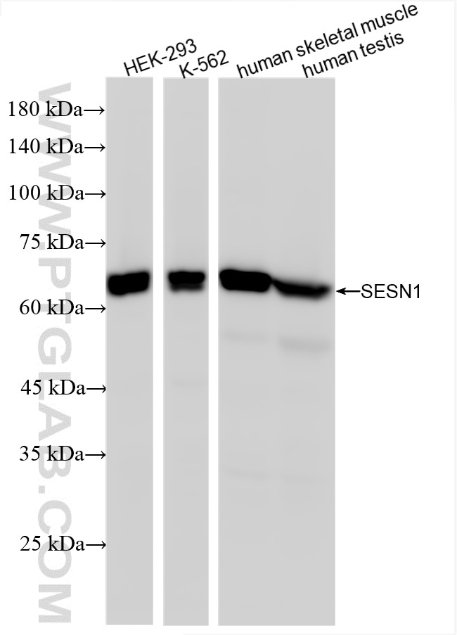 Western Blot (WB) analysis of various lysates using SESN1 Recombinant antibody (86008-1-RR)