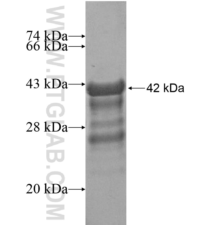 SESN1 fusion protein Ag16462 SDS-PAGE