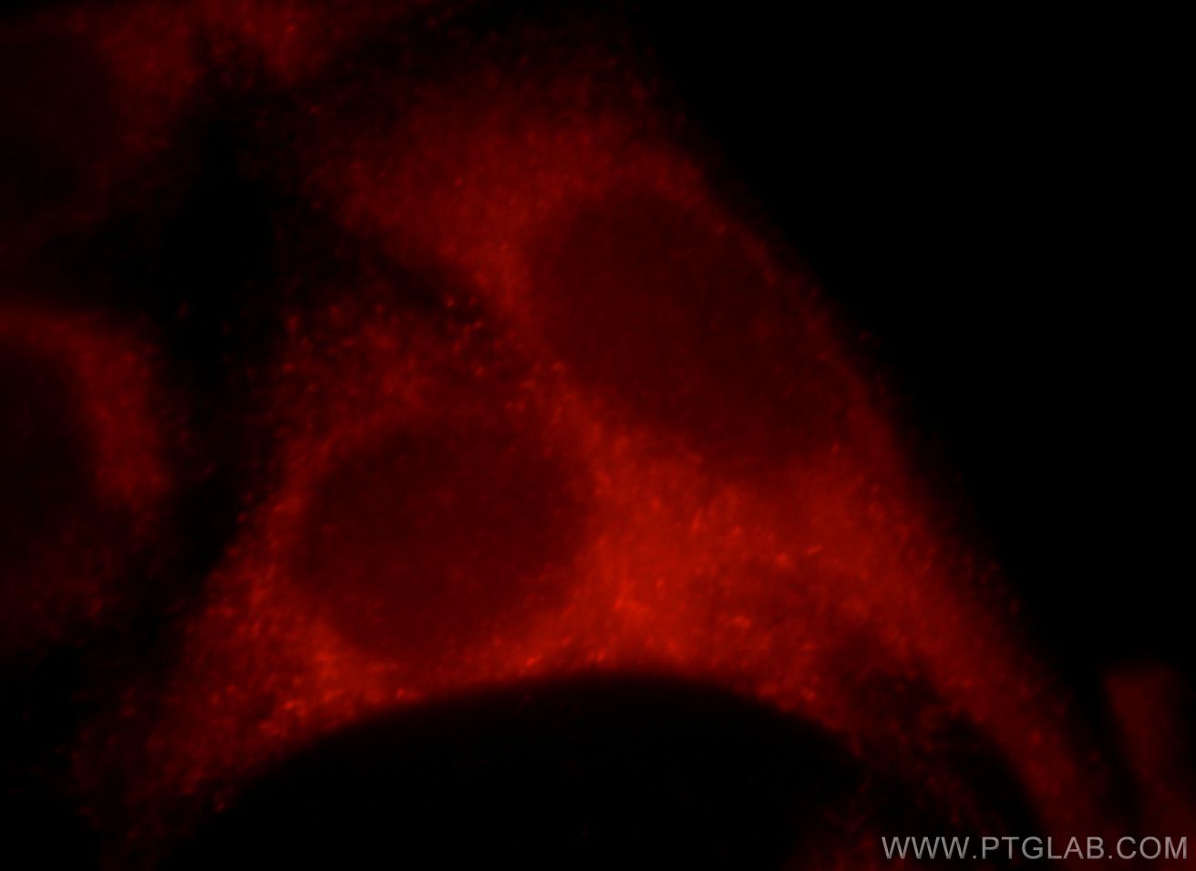 Immunofluorescence (IF) / fluorescent staining of HeLa cells using Sestrin 2 Polyclonal antibody (21346-1-AP)