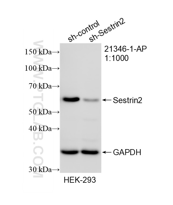Western Blot (WB) analysis of HEK-293 cells using Sestrin 2 Polyclonal antibody (21346-1-AP)