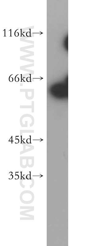 Western Blot (WB) analysis of HeLa cells using Sestrin 2 Polyclonal antibody (21346-1-AP)