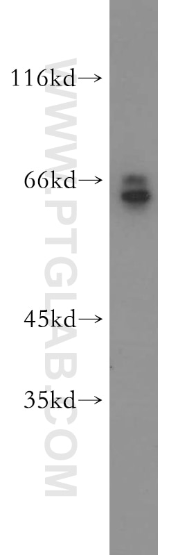 Western Blot (WB) analysis of NIH/3T3 cells using Sestrin 2 Polyclonal antibody (21346-1-AP)