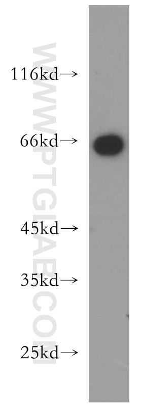 Western Blot (WB) analysis of mouse lung tissue using Sestrin 2 Polyclonal antibody (21346-1-AP)