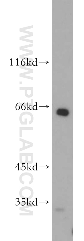 Western Blot (WB) analysis of mouse thymus tissue using Sestrin 2 Polyclonal antibody (21346-1-AP)