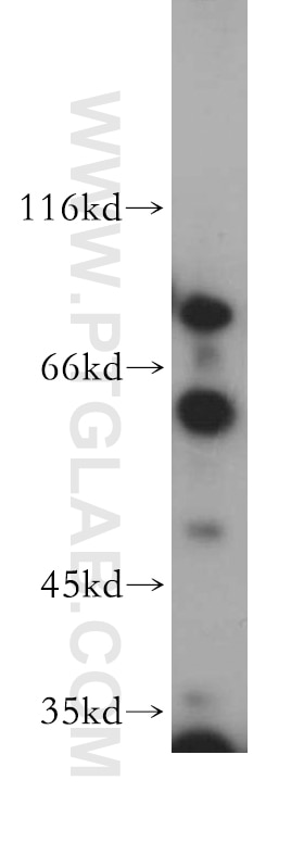 Western Blot (WB) analysis of K-562 cells using Sestrin 2 Polyclonal antibody (21346-1-AP)