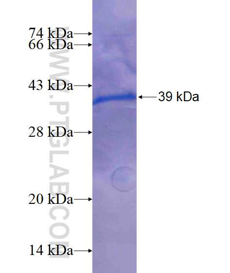 SESN2 fusion protein Ag15669 SDS-PAGE