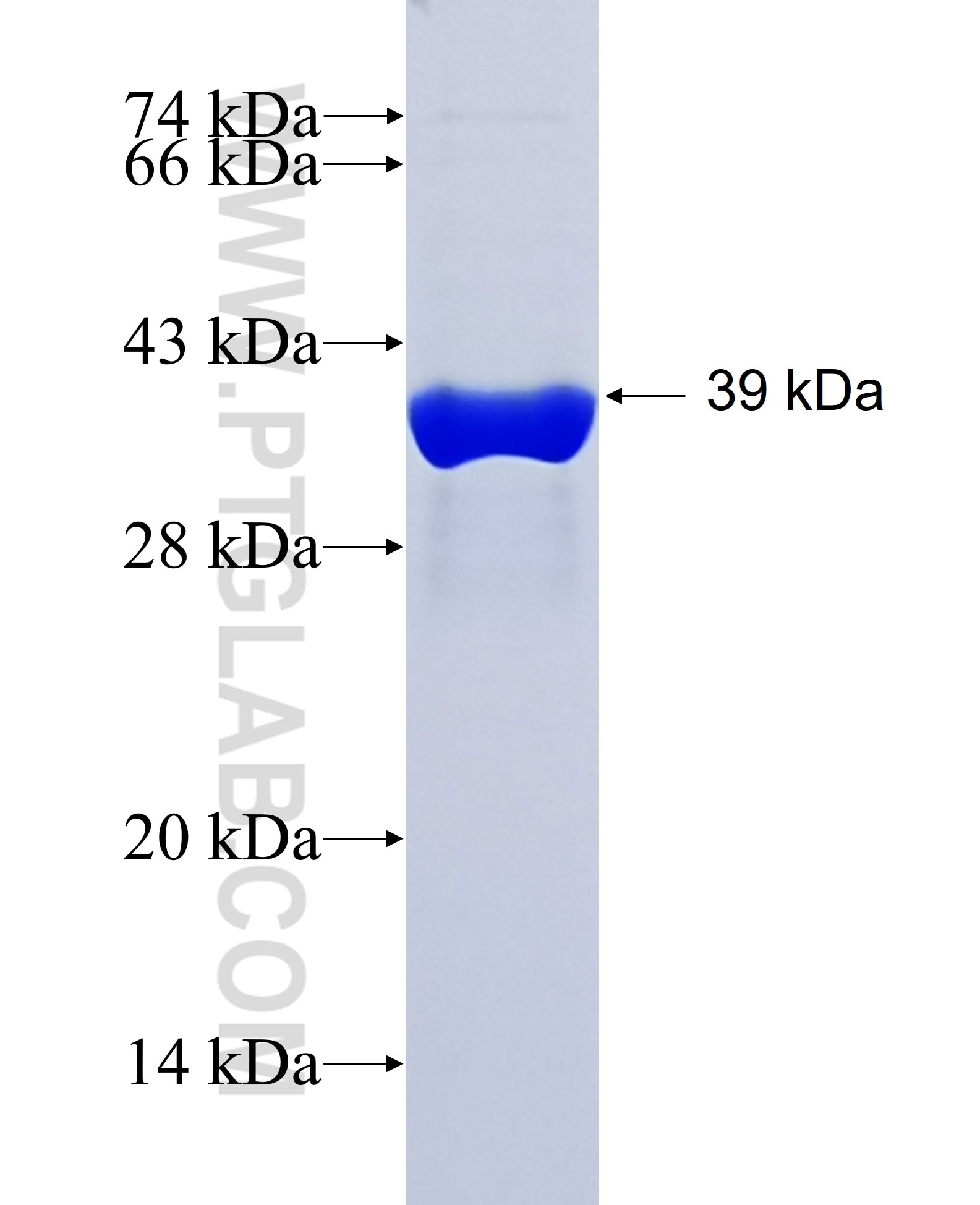 SESN2 fusion protein Ag15669 SDS-PAGE